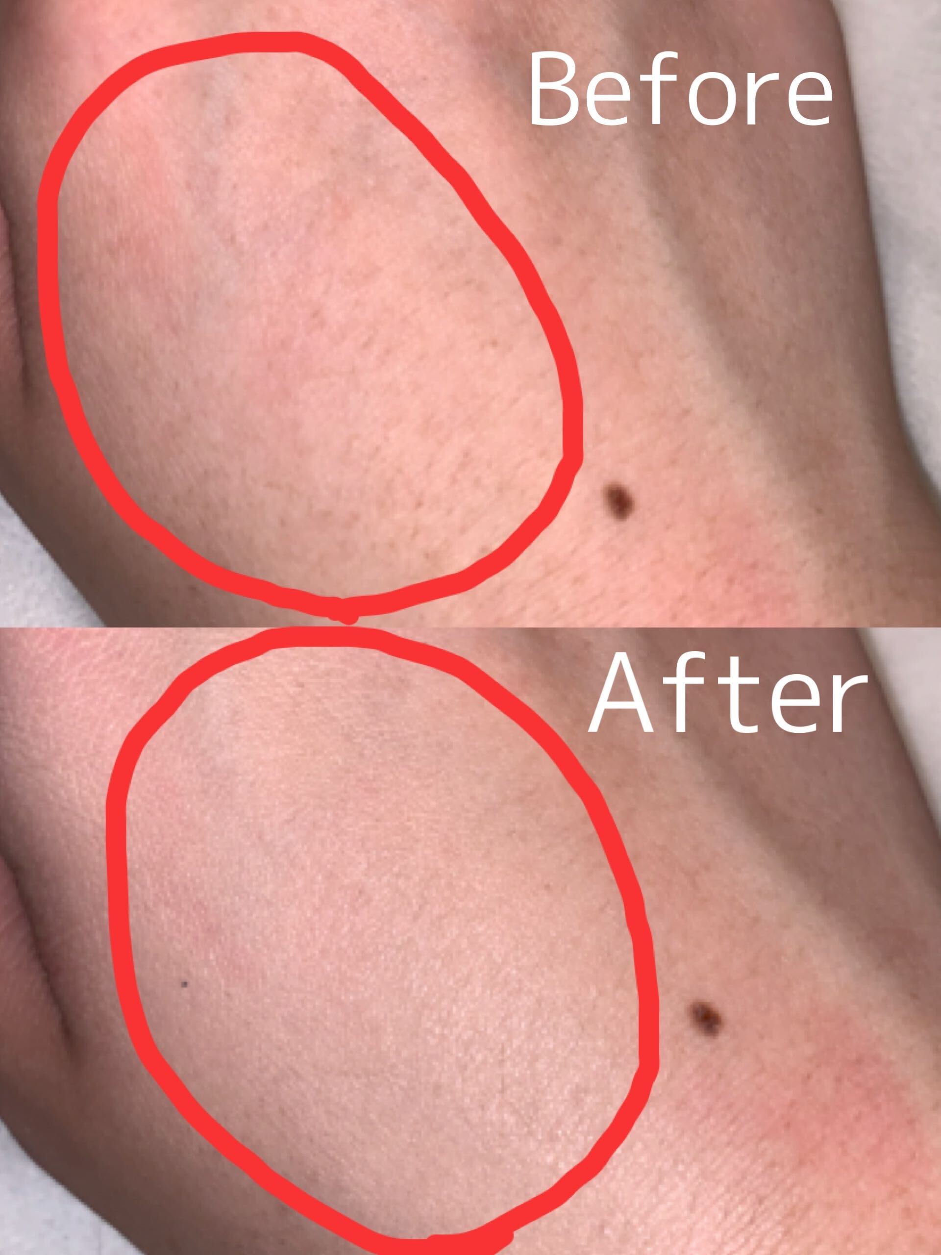 メディアファンで比較